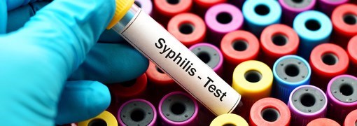 בדיקת נוגדנים לעגבת (Syphilis Antibodies) - תמונה